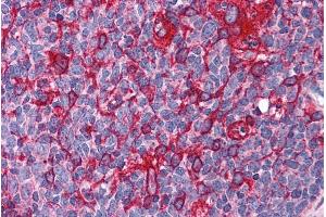 ABIN184829 (3. (ARL6IP5 anticorps  (C-Term))