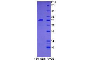 SDS-PAGE of Protein Standard from the Kit (Highly purified E. (Bcl-2 Kit CLIA)