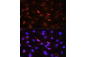 Immunofluorescence analysis of NIH/3T3 cells using Phospho-Jak1-Y1022/1023 antibody (ABIN6135246, ABIN6136118, ABIN6136119 and ABIN6225560) at dilution of 1:100. (JAK1 anticorps  (pTyr1022, pTyr1023))
