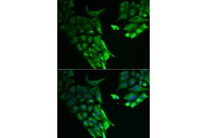 Immunofluorescence analysis of A549 cell using HABP2 antibody.