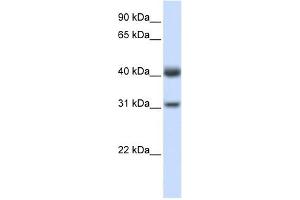 PDSS2 antibody used at 1 ug/ml to detect target protein.