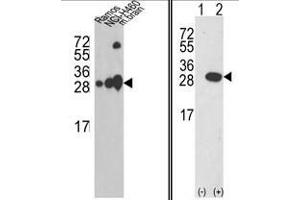 (LEFT) Western blot analysis of UCHL1 Antibody (C-term) in Ramos, NCI-H460 cell line and mouse brain tissue lysates (35ug/lane). (UCHL1 anticorps  (C-Term))