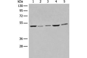 Western blot analysis of Raji Hela A549 HEPG2 and 231 cell lysates using EIF4A3 Polyclonal Antibody at dilution of 1:500