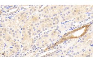 Detection of MMP13 in Human Kidney Tissue using Polyclonal Antibody to Matrix Metalloproteinase 13 (MMP13) (MMP13 anticorps  (AA 290-468))