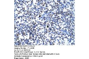 Human Spleen (GCM1 anticorps  (N-Term))