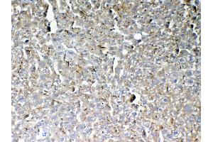 IHC analysis of GALNS using anti-GALNS antibody .