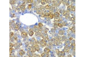 Immunohistochemistry of paraffin-embedded Mouse liver using FAH Polyclonal Antibody at dilution of 1:100 (40x lens).