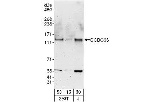 anti-Coiled-Coil Domain Containing 66 (CCDC66) (AA 898-948) antibody