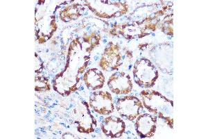 Immunohistochemistry of paraffin-embedded mouse kidney using M Rabbit pAb (ABIN6130539, ABIN6143505, ABIN6143506 and ABIN6221614) at dilution of 1:100 (40x lens). (MAP4 anticorps  (AA 942-1152))