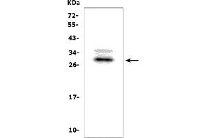 Western blot analysis of BAMBI using anti-BAMBI antibody (ABIN7600896).