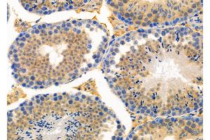 ABIN6259873 and ABIN6273990 at 1/100 staining Mouse testis tissue by IHC-P.