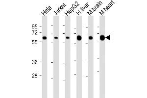 All lanes : Anti-PGM1 Antibody (Center) at 1:2000 dilution Lane 1: Hela whole cell lysate Lane 2: Jurkat whole cell lysate Lane 3: HepG2 whole cell lysate Lane 4: human liver lysate Lane 5: mouse brain lysate Lane 6: mouse heart lysate Lysates/proteins at 20 μg per lane. (Phosphoglucomutase 1 anticorps  (AA 251-282))