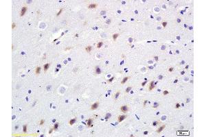 Formalin-fixed and paraffin embedded rat brain labeled with Anti-Bdkrb2/B2R Polyclonal Antibody, Unconjugated  at 1:200 followed by conjugation to the secondary antibody and DAB staining. (BDKRB2 anticorps  (AA 51-150))