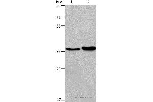 Western blot analysis of Human testis tissue and transitional cell carcinoma of bladder tissue, using FUT1 Polyclonal Antibody at dilution of 1:250