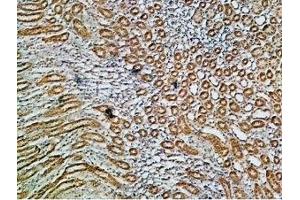 Expression of Na+/K+ ATPase α1 (ATP1A1) in rat kidney - Immunohistochemical staining of paraffin embedded rat kidney sections using Anti-Alpha 1 Na+/K+ ATPase Antibody (ABIN7043659, ABIN7044637 and ABIN7044638), (1:200). (ATP1A1 anticorps  (Intracellular, N-Term))
