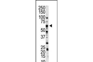 Western blot analysis of anti-NLK Pab in A375 cell lysate (Nemo-Like Kinase anticorps  (C-Term))