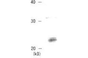 Western Blotting (WB) image for anti-Chromobox Homolog 3 (CBX3) (C-Term) antibody (ABIN2452035) (CBX3 anticorps  (C-Term))