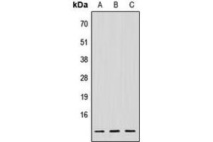 Western blot analysis of NDUFV3 expression in HeLa (A), Raw264. (NDUFV3 anticorps  (Center))