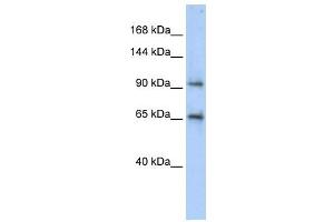 CCDC52 antibody used at 1 ug/ml to detect target protein. (SPICE1 anticorps  (Middle Region))