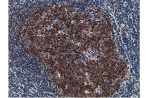 Image no. 2 for anti-Deoxycytidine Kinase (DCK) antibody (ABIN1497773)