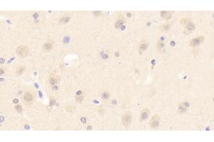 Detection of ASM in Human Cerebrum Tissue using Polyclonal Antibody to Acid Sphingomyelinase (ASM) (SMPD1 anticorps  (AA 319-579))