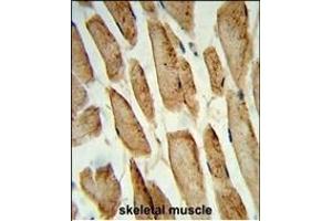 Formalin-fixed and paraffin-embedded human skeletal muscle reacted with POLG2 Antibody (C-term), which was peroxidase-conjugated to the secondary antibody, followed by DAB staining.