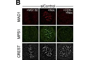 PP2A-B55 counteracts CDK1-dependent MPS1 localization to kinetochores and checkpoint signaling.
