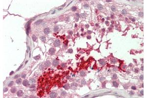 Rabbit Anti-BRDT antibody  Formalin Fixed Paraffin Embedded Tissue: Human Testis Primary antibody Concentration: 1:100 Secondary Antibody: Donkey anti-Rabbit-Cy3 Secondary Antibody Concentration: 1:200 Magnification: 20x Exposure Time: 0.