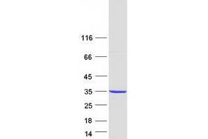 Validation with Western Blot