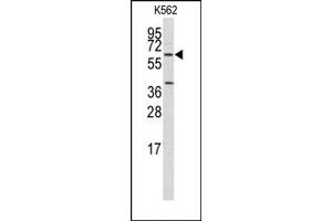 Image no. 1 for anti-Kruppel-Like Factor 4 (Gut) (KLF4) antibody (ABIN357865) (KLF4 anticorps)