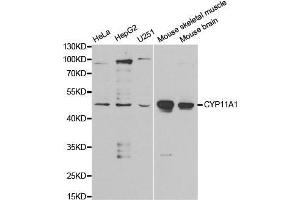 Western blot analysis of extracts of various cell lines, using CYP11A1 antibody. (CYP11A1 anticorps  (AA 40-320))