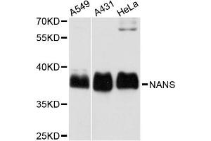 Western blot analysis of extracts of various cell lines, using NANS antibody (ABIN5972748) at 1:3000 dilution.
