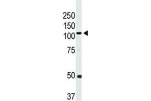 Western blot analysis of BMPR2 antibody and mouse heart tissue lysate