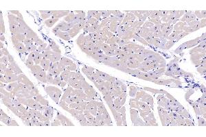 Detection of PDLIM1 in Human Cardiac Muscle Tissue using Polyclonal Antibody to PDZ And LIM Domain Protein 1 (PDLIM1) (PDLIM1 anticorps  (AA 2-329))
