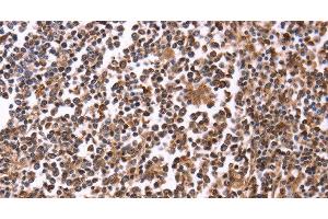 Immunohistochemistry of paraffin-embedded Human tonsil tissue using CRK Polyclonal Antibody at dilution 1:40 (Crk anticorps)
