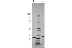 SDS-PAGE of Human Rat Fibroblast Growth Factor basic Recombinant Protein SDS-PAGE of Rat Fibroblast Growth Factor basic Recombinant Protein. (FGF2 Protéine)