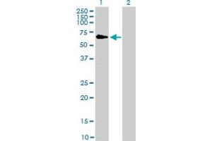 Western Blot analysis of RAF1 expression in transfected 293T cell line by RAF1 monoclonal antibody (M03), clone 1H4. (RAF1 anticorps  (AA 1-130))