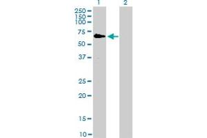 Western Blot analysis of RAF1 expression in transfected 293T cell line by RAF1 monoclonal antibody (M03), clone 1H4. (RAF1 anticorps  (AA 1-130))