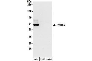 Western Blotting (WB) image for anti-Purinergic Receptor P2X, Ligand-Gated Ion Channel, 5 (P2RX5) (AA 372-422) antibody (ABIN7450531)