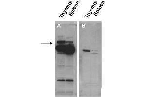 Image no. 1 for anti-Pogo Transposable Element with ZNF Domain (POGZ) (N-Term) antibody (ABIN401435) (POGZ anticorps  (N-Term))