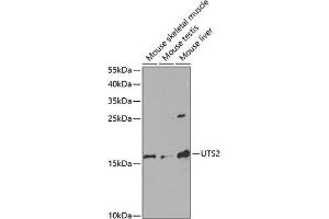 Western blot analysis of extracts of various cell lines, using UTS2 antibody (ABIN6128895, ABIN6150039, ABIN6150040 and ABIN6220965) at 1:1000 dilution. (Urotensin 2 anticorps  (AA 35-124))
