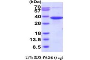 SDS-PAGE (SDS) image for Phosphoglycolate Phosphatase (PGP) (AA 1-321) (Active) protein (His tag) (ABIN6388008)