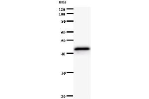 Western Blotting (WB) image for anti-Protein Kinase, CAMP-Dependent, Regulatory, Type I, alpha (Tissue Specific Extinguisher 1) (PRKAR1A) antibody (ABIN931105)