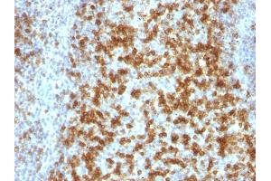 Formalin-fixed, paraffin-embedded human Tonsil stained with PD1 (CD279) Monoclonal Antibody (PDCD1/922). (PD-1 anticorps)