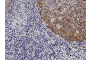Immunoperoxidase of monoclonal antibody to XCL1 on formalin-fixed paraffin-embedded human tonsil.