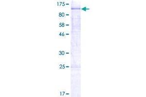 Image no. 1 for Melanoma Antigen Family D, 2 (MAGED2) (AA 1-606) protein (GST tag) (ABIN1310082)