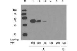 Lane 1,2,3 and 6: WISP2 full length recombinant protein with GST tag in 293 cell lysateLane 4: 10 µg 293 cell lysateLane 5: GST proteinPrimary antibody: A: 1 µg/mL Mouse Anti-WISP2 Monoclonal Antibody (ABIN398657) B: Negative controlSecondary antibody: Goat Anti-Mouse IgG (H&L) [HRP] Polyclonal Antibody (ABIN398387, 1: 10,000) The signal was developed with LumiSensorTM HRP Substrate Kit (ABIN769939) (WISP2 anticorps)