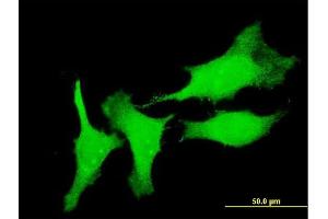 Immunofluorescence of monoclonal antibody to CSRP3 on HeLa cell.