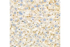 Immunohistochemistry of paraffin embedded rat liver using CEACAM1 (ABIN7073315) at dilution of 1: 650 (400x lens)