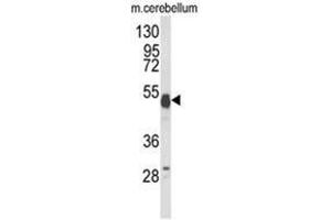 Western blot analysis of UBAP1 Antibody (N-term) in mouse cerebellum tissue lysates (35ug/lane). (UBAP1 anticorps  (N-Term))